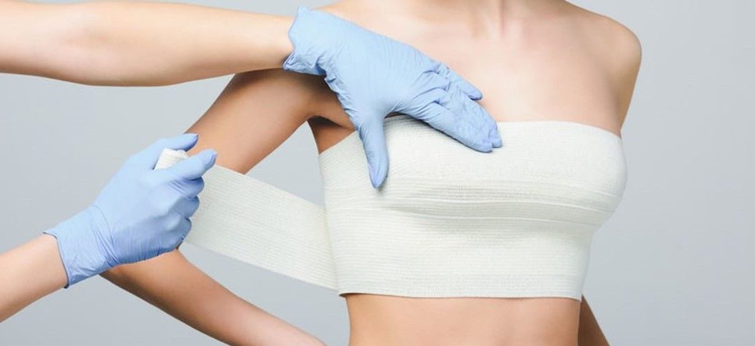 Fat Grafting Breast Augmentation: Insights and Overview