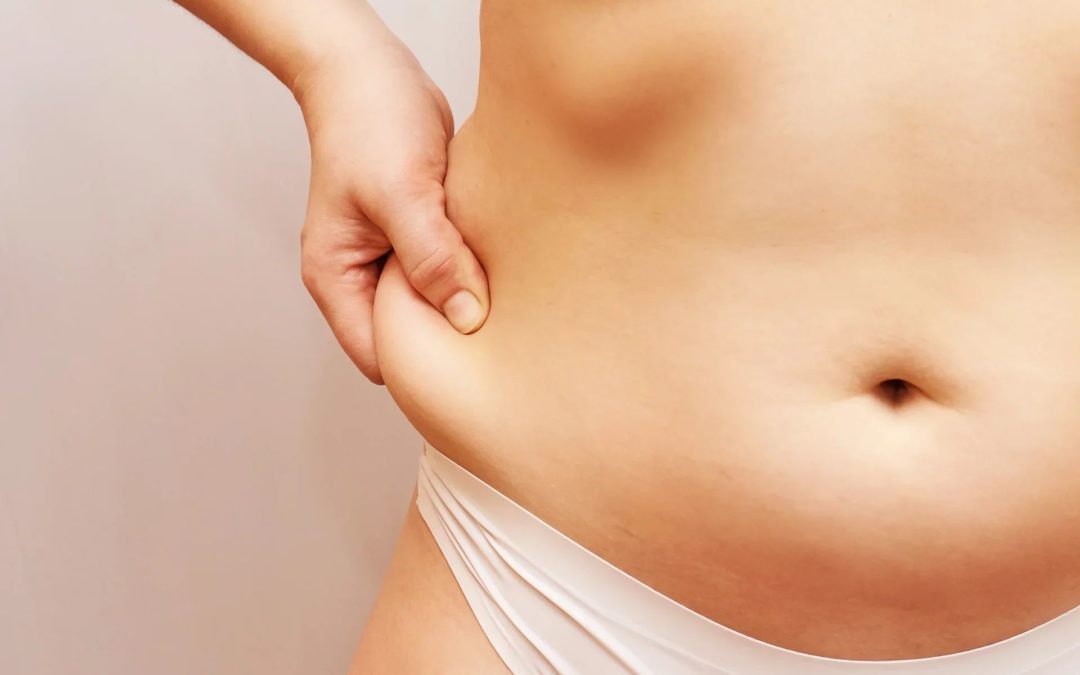 Understanding Local Liposuction: A Comprehensive Guide