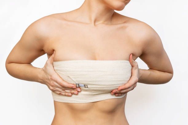 Fat Transfer Breast Reconstruction: Insights and Guide